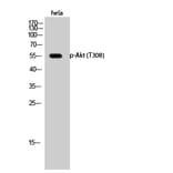 Western Blot - Anti-Akt (phospho Thr308) Antibody (A7005) - Antibodies.com