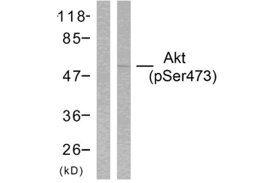 Western Blot - Anti-Akt (phospho Ser473) Antibody (A7004) - Antibodies.com