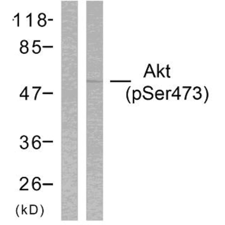Western Blot - Anti-Akt (phospho Ser473) Antibody (A7004) - Antibodies.com