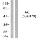 Western Blot - Anti-Akt (phospho Ser473) Antibody (A7004) - Antibodies.com
