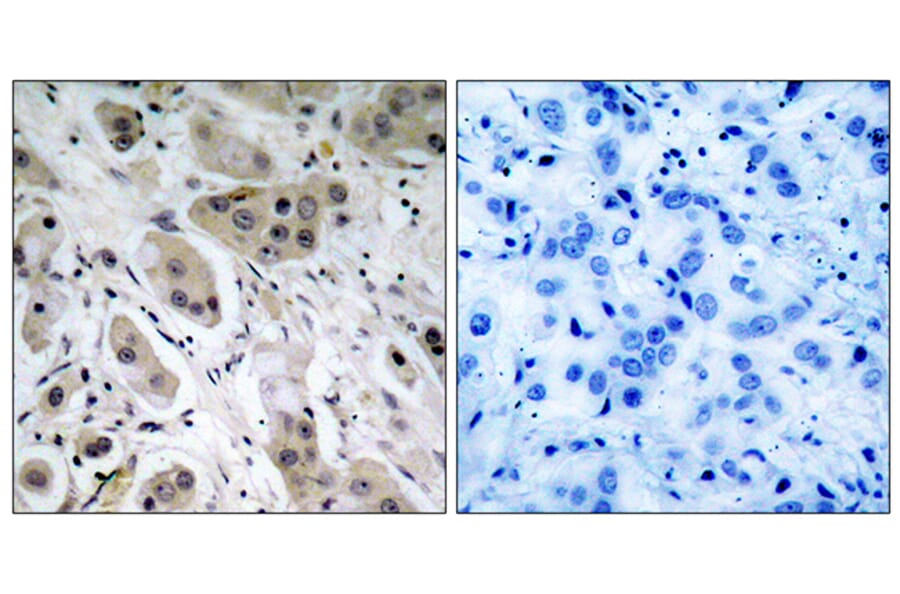 Immunohistochemistry - Anti-Akt (phospho Ser473) Antibody (A7004) - Antibodies.com