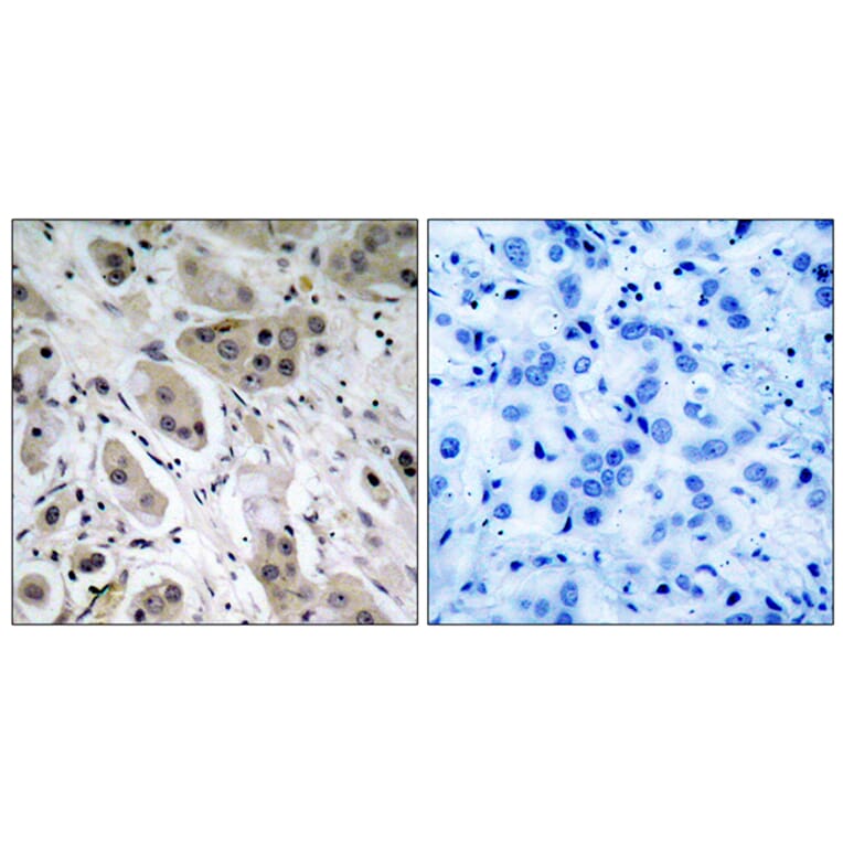 Immunohistochemistry - Anti-Akt (phospho Ser473) Antibody (A7004) - Antibodies.com