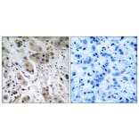 Immunohistochemistry - Anti-Akt (phospho Ser473) Antibody (A7004) - Antibodies.com