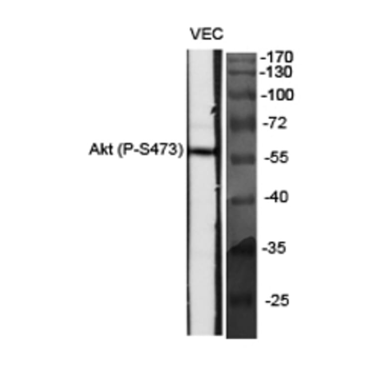 Western Blot - Anti-Akt (phospho Ser473) Antibody (A7004) - Antibodies.com