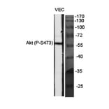 Western Blot - Anti-Akt (phospho Ser473) Antibody (A7004) - Antibodies.com