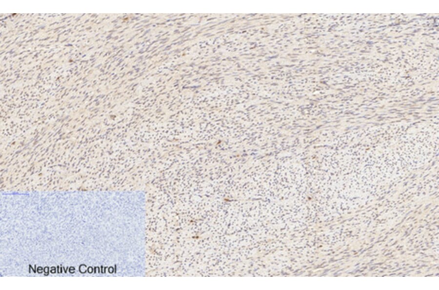 Immunohistochemistry - Anti-Akt (phospho Ser473) Antibody (A7004) - Antibodies.com