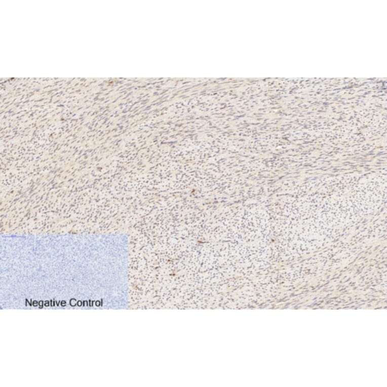 Immunohistochemistry - Anti-Akt (phospho Ser473) Antibody (A7004) - Antibodies.com