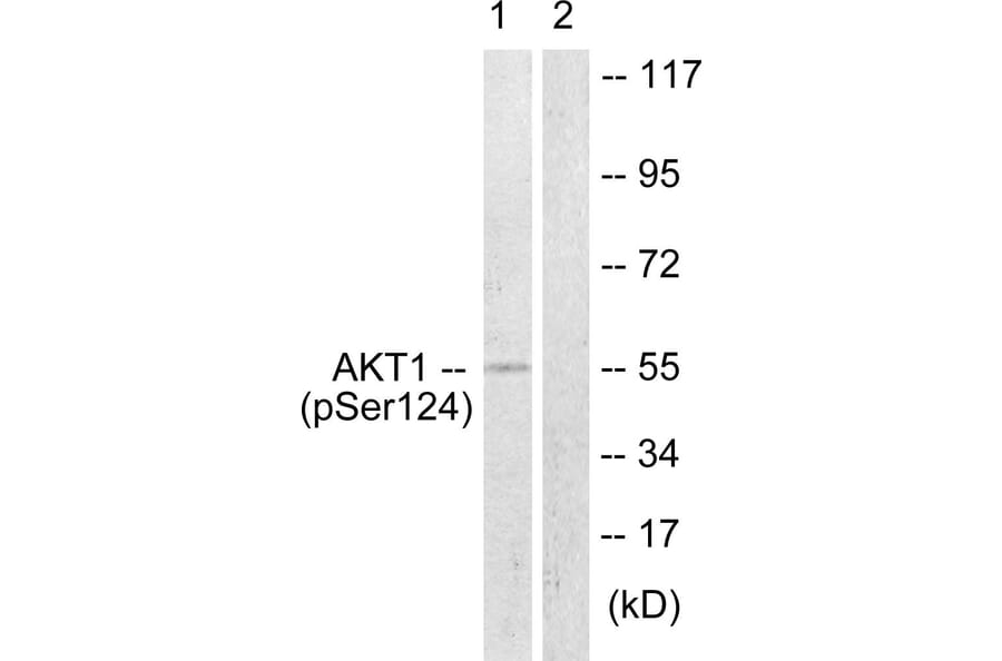 Western Blot - Anti-Akt (phospho Ser124) Antibody (A0407) - Antibodies.com