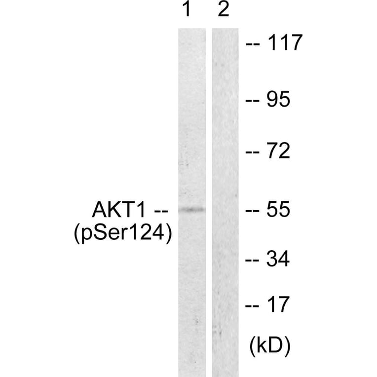 Western Blot - Anti-Akt (phospho Ser124) Antibody (A0407) - Antibodies.com