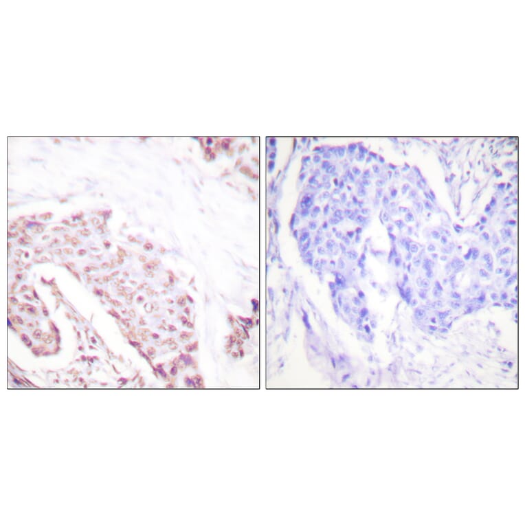 Immunohistochemistry - Anti-Akt (phospho Ser124) Antibody (A0407) - Antibodies.com