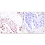Immunohistochemistry - Anti-Akt (phospho Ser124) Antibody (A0407) - Antibodies.com