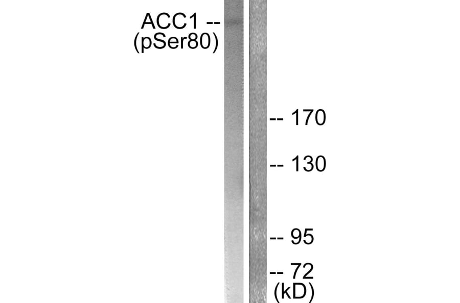 Western Blot - Anti-ACC1 (phospho Ser80) Antibody (A0405) - Antibodies.com