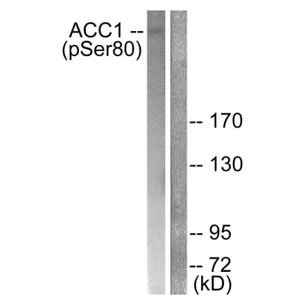 Western Blot - Anti-ACC1 (phospho Ser80) Antibody (A0405) - Antibodies.com