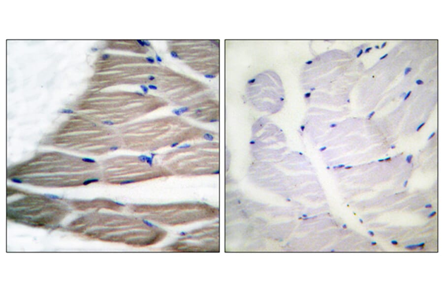 Immunohistochemistry - Anti-ACC1 (phospho Ser80) Antibody (A0405) - Antibodies.com