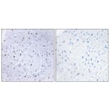 Immunohistochemistry - Anti-53BP1 (phospho Ser6) Antibody (A0760) - Antibodies.com