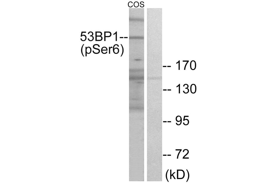 Western Blot - Anti-53BP1 (phospho Ser6) Antibody (A0760) - Antibodies.com