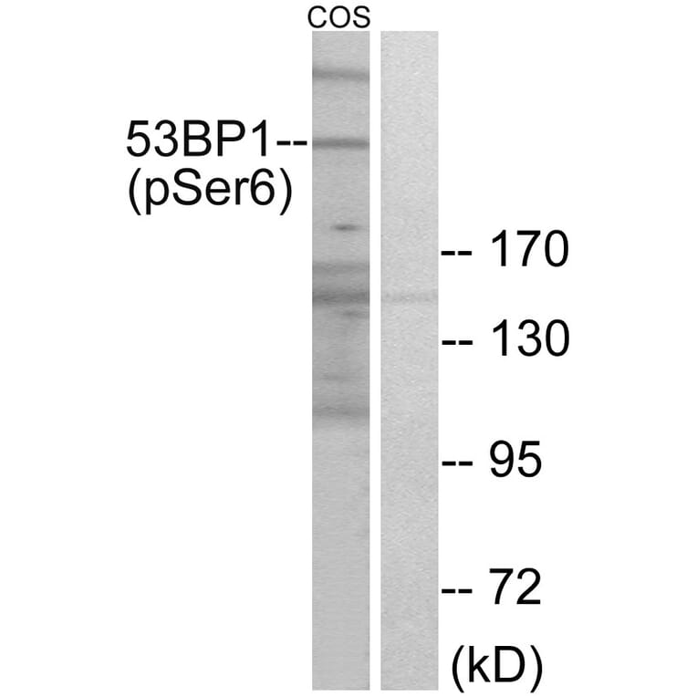 Western Blot - Anti-53BP1 (phospho Ser6) Antibody (A0760) - Antibodies.com