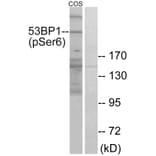 Western Blot - Anti-53BP1 (phospho Ser6) Antibody (A0760) - Antibodies.com