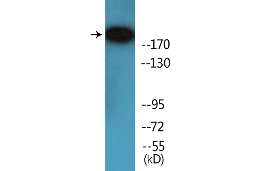 Western Blot - Anti-53BP1 (phospho Ser6) Antibody (P12-1070) - Antibodies.com