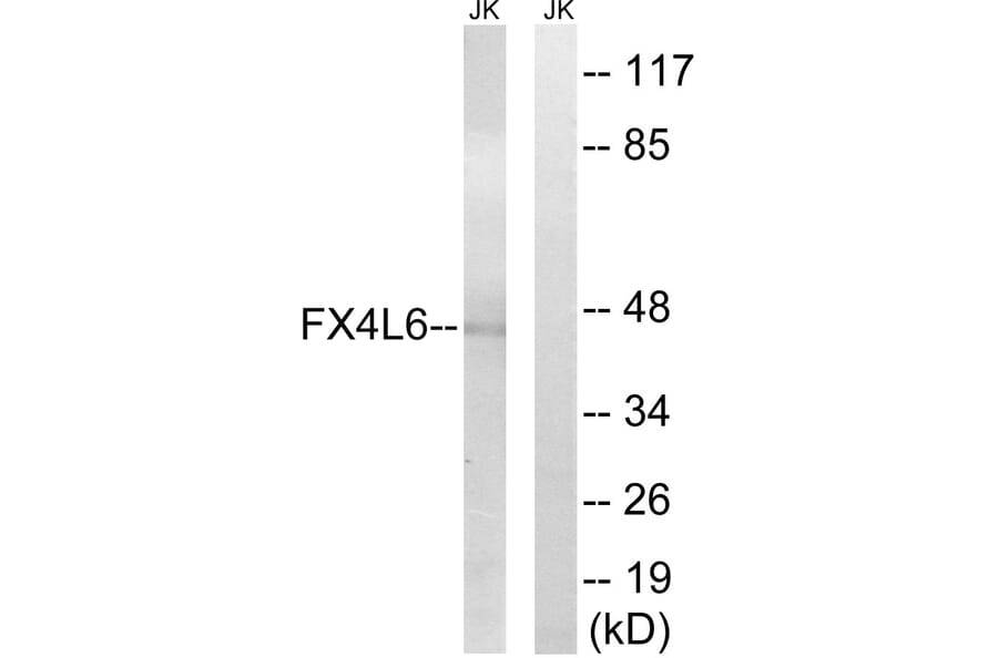 Western Blot - Anti-FOXD4 + L2 + L3 + L4 + L5 + L6 Antibody (C15778) - Antibodies.com