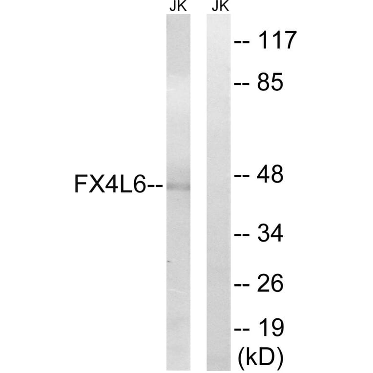 Western Blot - Anti-FOXD4 + L2 + L3 + L4 + L5 + L6 Antibody (C15778) - Antibodies.com