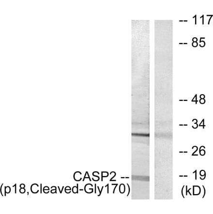 Western Blot - Anti-Caspase 2 (p18,cleaved Gly170) Antibody (L0151) - Antibodies.com