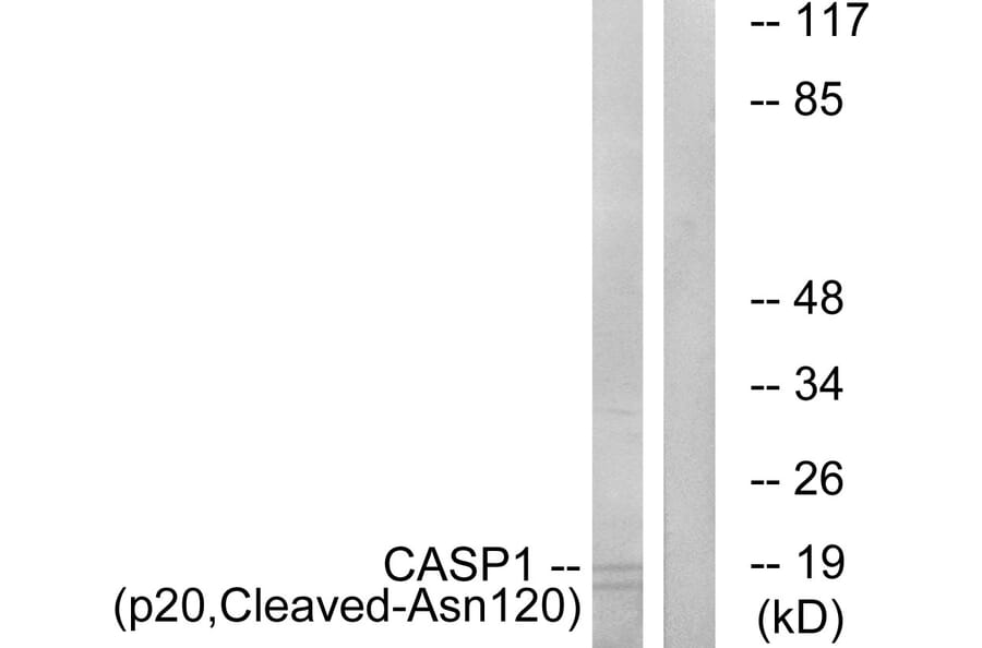 Western Blot - Anti-Caspase 1 (p20,cleaved Asn120) Antibody (L0143) - Antibodies.com