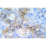 Immunohistochemistry - Anti-HSP27 (phospho Ser78 + Ser82) Antibody (P12-1028) - Antibodies.com