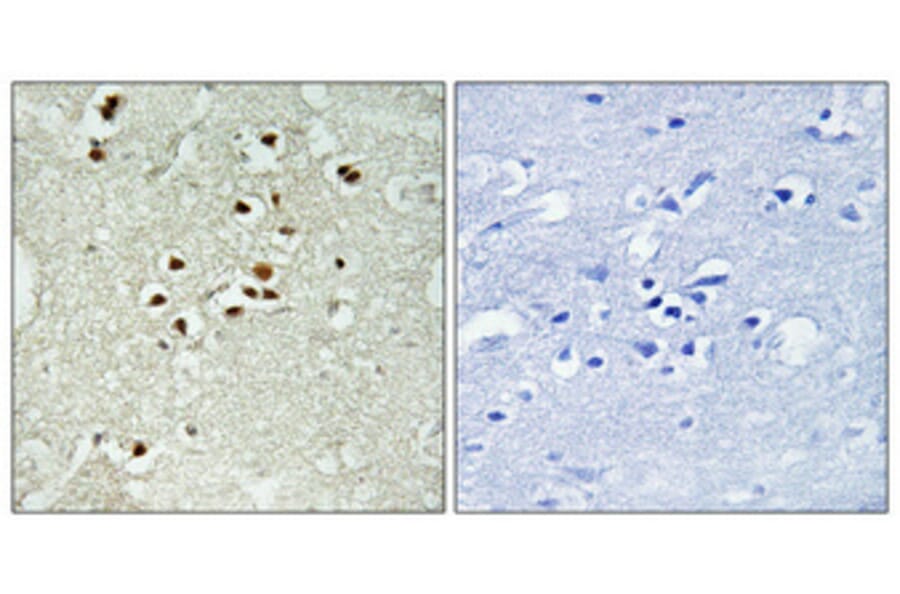 Immunohistochemistry - Anti-DNA Ligase 4 (phospho Thr650) Antibody (A1197) - Antibodies.com