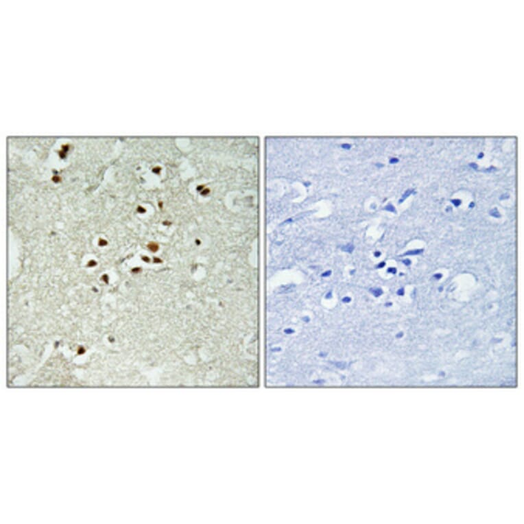 Immunohistochemistry - Anti-DNA Ligase 4 (phospho Thr650) Antibody (A1197) - Antibodies.com