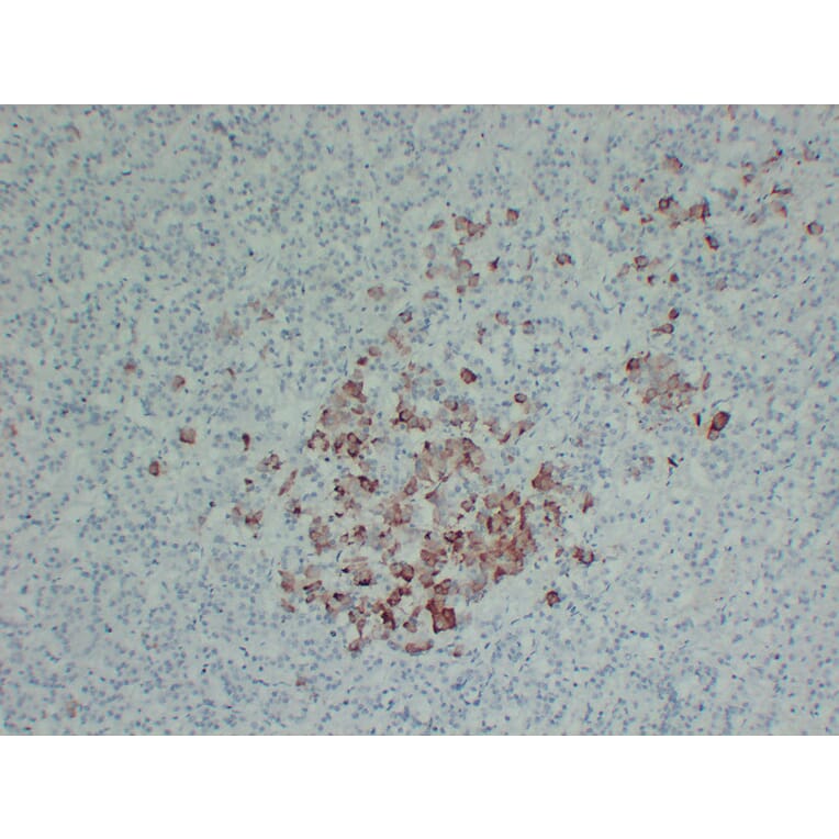Immunohistochemistry - Anti-Thyroid Stimulating Hormone Antibody (V0135) - Antibodies.com