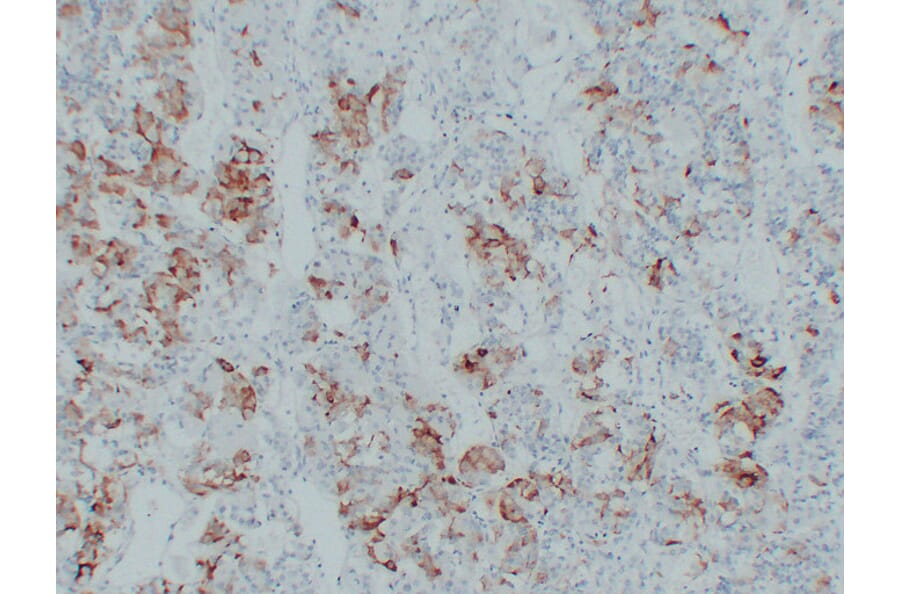 Immunohistochemistry - Anti-Thyroid Stimulating Hormone Antibody (V0135) - Antibodies.com