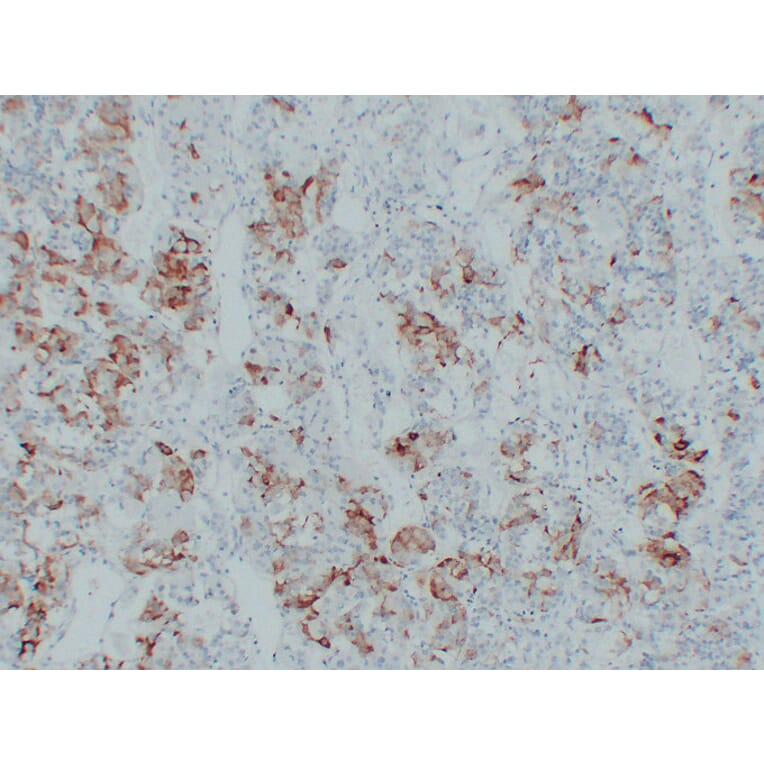 Immunohistochemistry - Anti-Thyroid Stimulating Hormone Antibody (V0135) - Antibodies.com