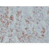 Immunohistochemistry - Anti-Thyroid Stimulating Hormone Antibody (V0135) - Antibodies.com