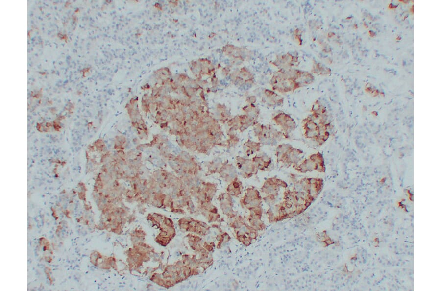 Immunohistochemistry - Anti-Thyroid Stimulating Hormone Antibody (V0135) - Antibodies.com