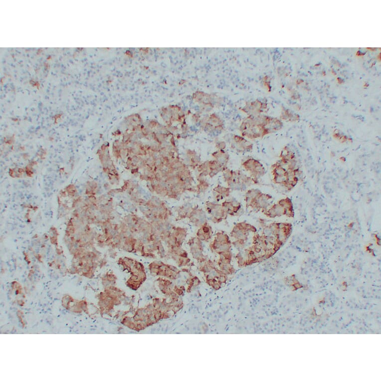 Immunohistochemistry - Anti-Thyroid Stimulating Hormone Antibody (V0135) - Antibodies.com