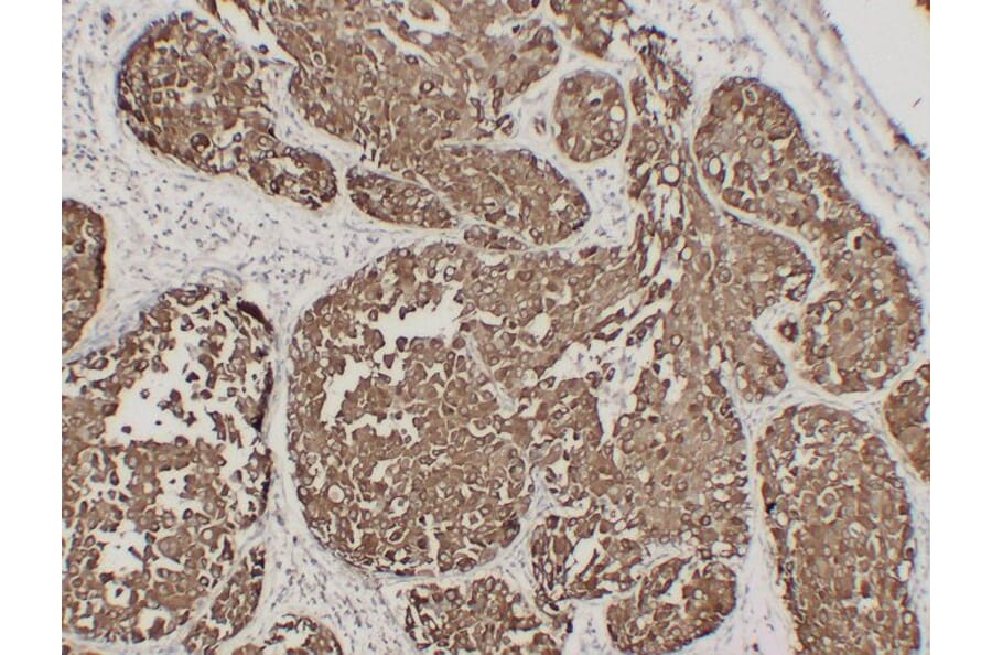 Immunohistochemistry - Anti-Epithelial Membrane Antigen Antibody (V0067) - Antibodies.com