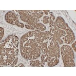 Immunohistochemistry - Anti-Epithelial Membrane Antigen Antibody (V0067) - Antibodies.com
