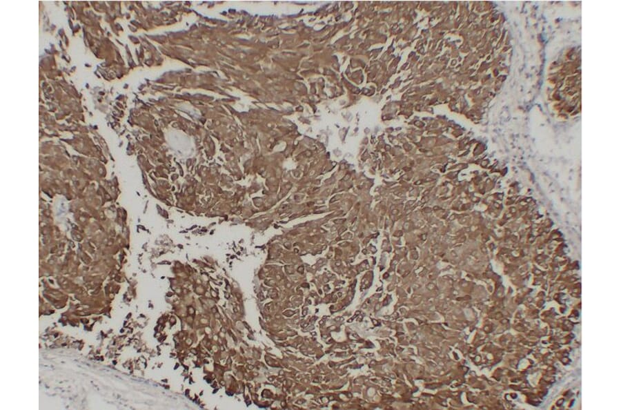 Immunohistochemistry - Anti-Epithelial Membrane Antigen Antibody (V0067) - Antibodies.com