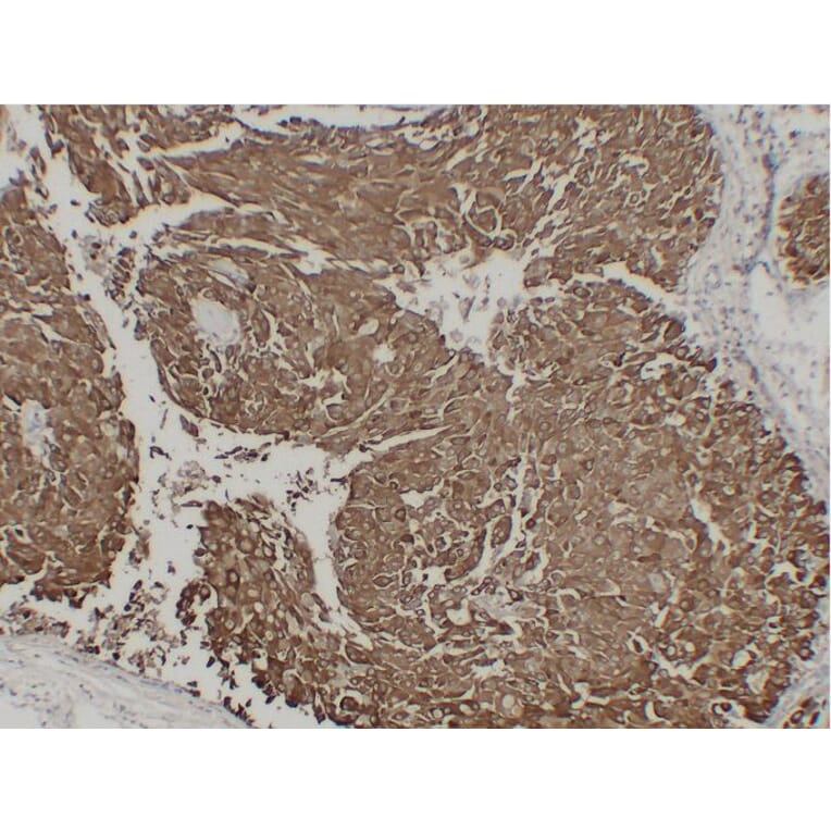 Immunohistochemistry - Anti-Epithelial Membrane Antigen Antibody (V0067) - Antibodies.com