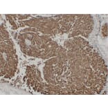 Immunohistochemistry - Anti-Epithelial Membrane Antigen Antibody (V0067) - Antibodies.com