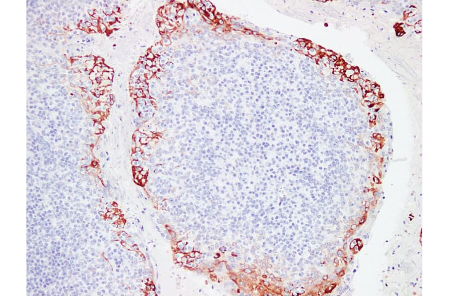 Immunohistochemistry - Anti-Epithelial Membrane Antigen Antibody (V0067) - Antibodies.com