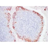 Immunohistochemistry - Anti-Epithelial Membrane Antigen Antibody (V0067) - Antibodies.com