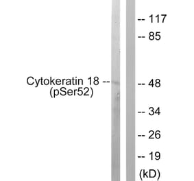 Western Blot - Anti-Keratin 18 (phospho Ser52) Antibody (A0882) - Antibodies.com