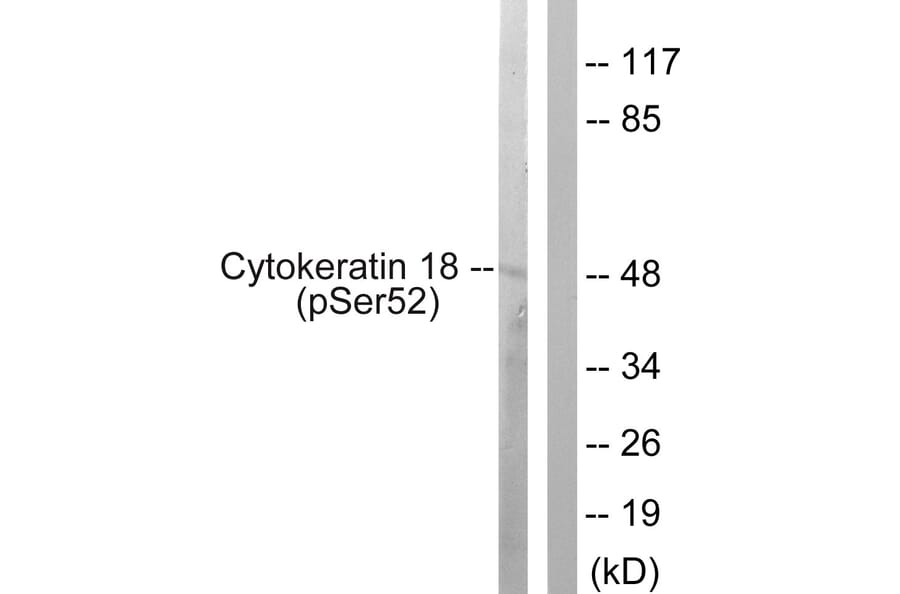 Western Blot - Anti-Keratin 18 (phospho Ser52) Antibody (A0882) - Antibodies.com