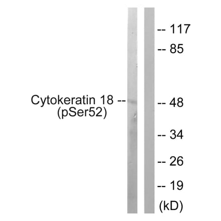 Western Blot - Anti-Keratin 18 (phospho Ser52) Antibody (A0882) - Antibodies.com