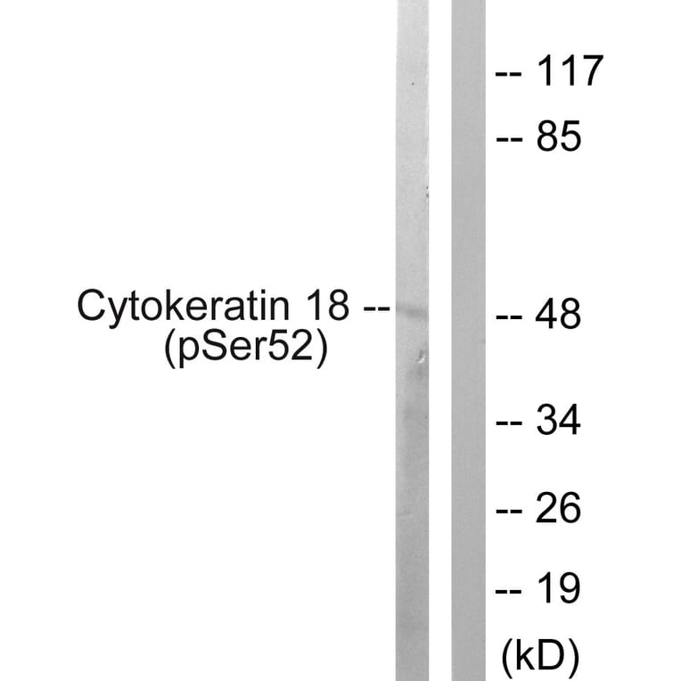 Western Blot - Anti-Keratin 18 (phospho Ser52) Antibody (A0882) - Antibodies.com