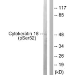 Western Blot - Anti-Keratin 18 (phospho Ser52) Antibody (A0882) - Antibodies.com