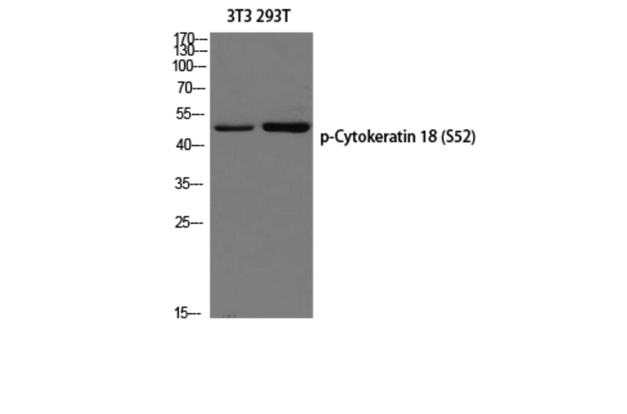 Western Blot - Anti-Keratin 18 (phospho Ser52) Antibody (A0882) - Antibodies.com