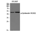 Western Blot - Anti-Keratin 18 (phospho Ser52) Antibody (A0882) - Antibodies.com